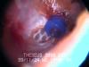 Inside the ear