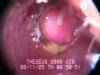 Inside the ear