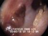 Inside the ear
