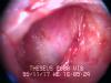 Inside the ear
