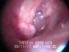 Inside the ear