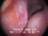 Inside the ear