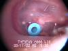 Inside the ear