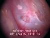 Inside the ear