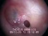 Inside the ear