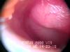 Inside the ear