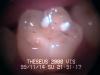 Inside the mouth