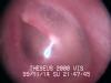 Inside the ear