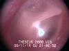 Inside the ear
